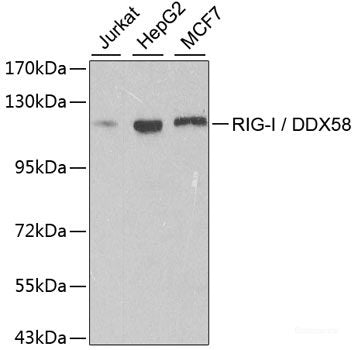 Western blot analysis of extracts of various cell lines using PLA2R1 Polyclonal Antibody at dilution of 1:1000.
