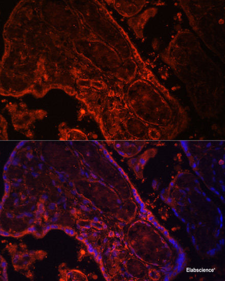Western blot analysis of extracts of SKOV3 cells using PAX8 Polyclonal Antibody.