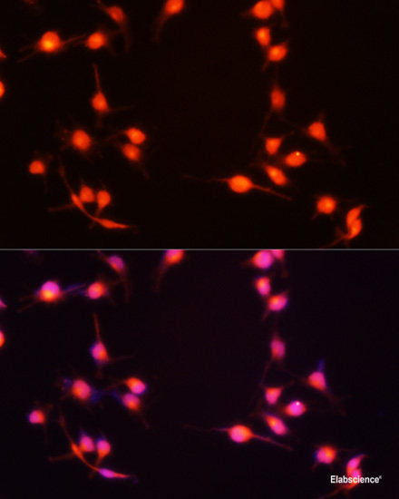 Immunofluorescence analysis of Mouse oophoroma cells using ZP2 Polyclonal Antibody at dilution of 1:100. Blue: DAPI for nuclear staining.