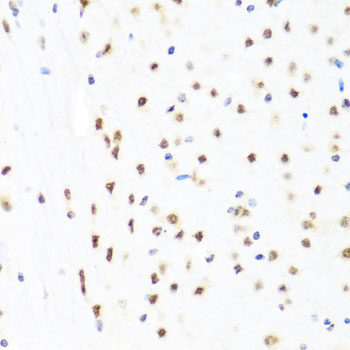 Western blot analysis of extracts of U2OS cells using CIR1 Polyclonal Antibody at dilution of 1:1000.