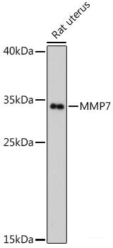 Western blot analysis of extracts of various cell lines using DUSP16 Polyclonal Antibody at dilution of 1:1000.