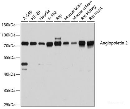 Western blot analysis of extracts of various cell lines using PPP1R14A Polyclonal Antibody at dilution of 1:1000.