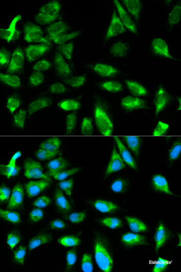 Western blot analysis of extracts of various cell lines using L3MBTL2 Polyclonal Antibody at dilution of 1:1000.