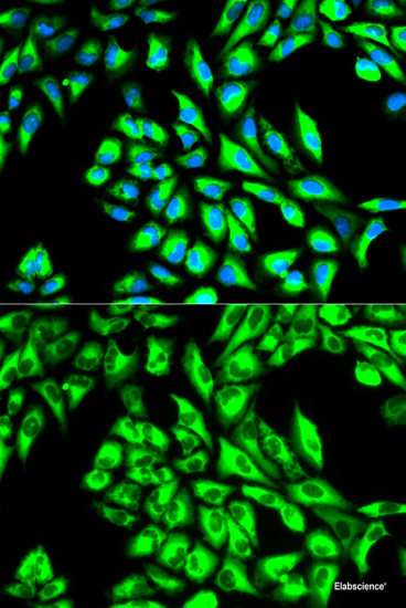 Western blot analysis of extracts of Mouse skeletal muscle using STRADA Polyclonal Antibody at dilution of 1:1000.
