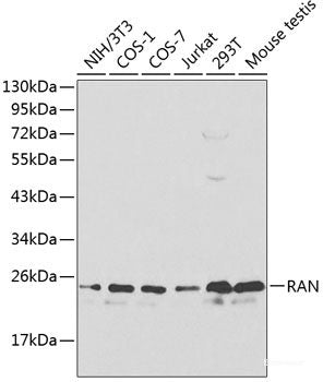 Immunohistochemistry of paraffin-embedded Human prostate using RAD23B Polyclonal Antibody at dilution of 1:100 (40x lens).