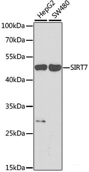Western blot analysis of extracts of Jurkat cells using CCDC61 Polyclonal Antibody at dilution of 1:1000.