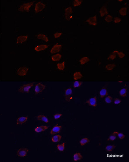 Western blot analysis of extracts of various cell lines using INPP1 Polyclonal Antibody at dilution of 1:1000.