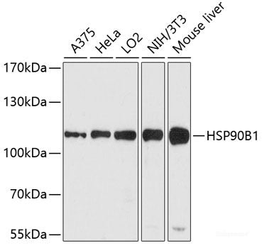 Immunohistochemistry of paraffin-embedded Human liver using KLHL42 Polyclonal Antibody at dilution of 1:100 (40x lens).