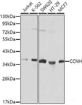 Western blot analysis of extracts of A-549 cells using HLA-F Polyclonal Antibody at dilution of 1:1000.