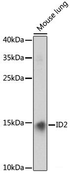 Immunohistochemistry of paraffin-embedded Human mammary cancer using MTHFD2 Polyclonal Antibody at dilution of 1:100 (40x lens).