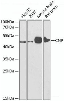 Western blot analysis of extracts of various cell lines using ACTR3 Polyclonal Antibody at dilution of 1:1000.