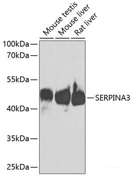 Western blot analysis of extracts of various cell lines using DPYSL5 Polyclonal Antibody at dilution of 1:3000.