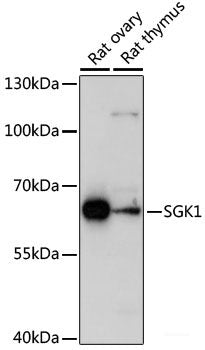 Western blot analysis of extracts of various cell lines using SDHB Polyclonal Antibody at dilution of 1:1000.