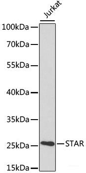 Immunohistochemistry of paraffin-embedded Rat heart using CTGF Polyclonal Antibody at dilution of 1:100 (40x lens).
