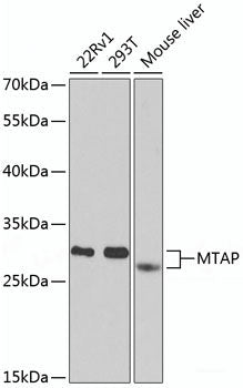 Immunohistochemistry of paraffin-embedded Rat brain using PPAR gamma Polyclonal Antibody at dilution of 1:100 (40x lens).