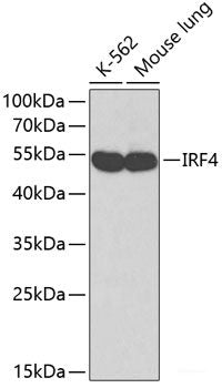 Immunohistochemistry of paraffin-embedded Rat liver using SQSTM1 / p62 Polyclonal Antibody at dilution of 1:200 (40x lens).