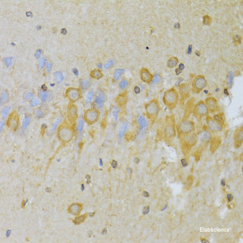 Western blot analysis of extracts of Mouse liver using AMACR Polyclonal Antibody at dilution of 1:1000.