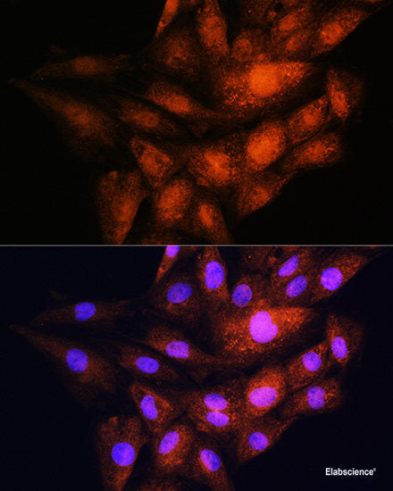Immunohistochemistry of paraffin-embedded Rat testis using Bcl-2 Polyclonal Antibody at dilution of 1:200 (40x lens).