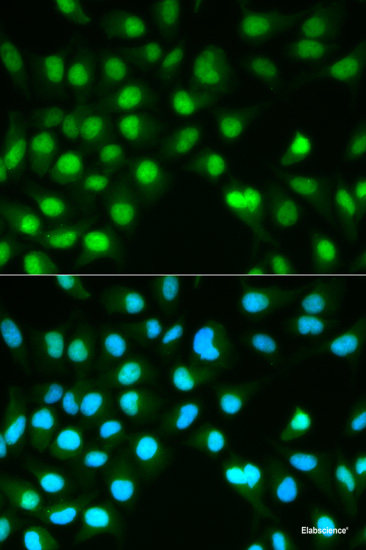 Western blot analysis of extracts of Mouse thymus using Caspase-8 Polyclonal Antibody at dilution of 1:1000.