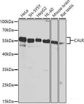 Western blot analysis of extracts of Mouse brain using DCX Polyclonal Antibody.