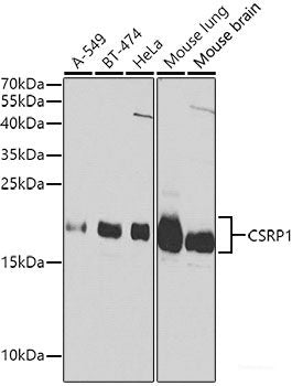 Immunohistochemistry of paraffin-embedded Rat ovary using mTOR Polyclonal Antibody at dilution of 1:150 (40x lens).