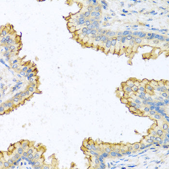 Immunofluorescence analysis of THP-1 cells using IL1 beta Polyclonal Antibody at dilution of 1:100. Blue: DAPI for nuclear staining.
