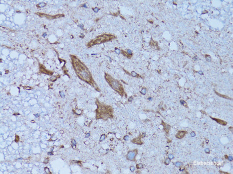 Immunofluorescence analysis of HeLa cells using MCM7 Polyclonal Antibody