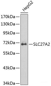 Western blot analysis of extracts of Mouse spleen using RAC2 Polyclonal Antibody at dilution of 1:1000.