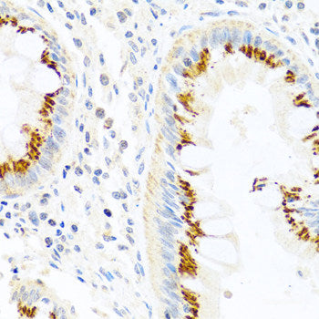 Immunohistochemistry of paraffin-embedded Human liver using ATG5 Polyclonal Antibody at dilution of 1:100 (40x lens).
