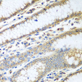 Western blot analysis of extracts of HeLa cells using Caspase-9 Polyclonal Antibody at dilution of 1:1000.