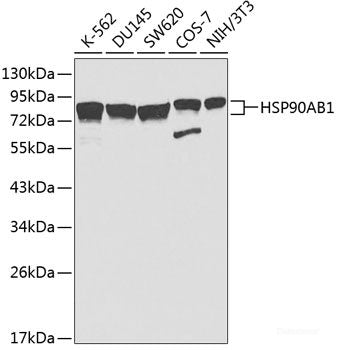 Western blot analysis of extracts of various cell lines using LDHA Polyclonal Antibody at dilution of 1:1000.