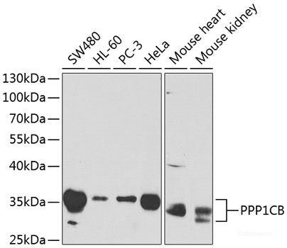 Western blot analysis of extracts of various cell lines using Histone H2AX Polyclonal Antibody at dilution of 1:1000.