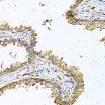 Immunofluorescence analysis of HeLa cells using LAMP1 Polyclonal Antibody at dilution of 1:100. Blue: DAPI for nuclear staining.