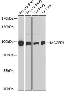 Western blot analysis of extracts of Rat ovary using SMAD3 Polyclonal Antibody at dilution of 1:1000.
