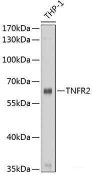 Western blot analysis of extracts of NIH/3T3 cells using JAK2 Polyclonal Antibody at dilution of 1:1000.
