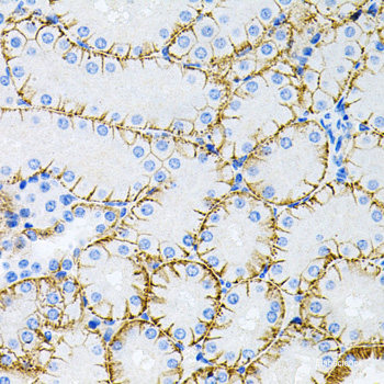 Immunohistochemistry of paraffin-embedded Rat testis using Histone H2AX Polyclonal Antibody at dilution of 1:100 (40x lens).
