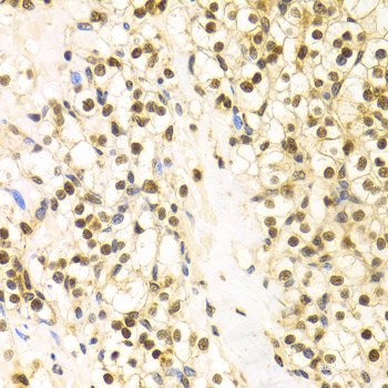 Immunohistochemistry of paraffin-embedded Human lung using TPM1 Polyclonal Antibody at dilution of 1:100 (40x lens).