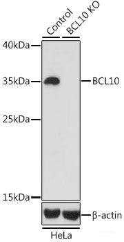 Western blot analysis of extracts of HeLa cells using EGFR Polyclonal Antibody at dilution of 1:3000.