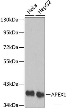 Western blot analysis of extracts of A-549 cells using LIMA1 Polyclonal Antibody at dilution of 1:3000.