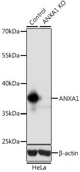 Immunofluorescence analysis of Hela cells using CHAMP1 Polyclonal Antibody at dilution of 1:100 (40x lens). Blue: DAPI for nuclear staining.
