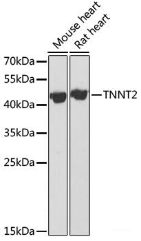 Immunofluorescence analysis of Rat pancreas using SERPINI2 Polyclonal Antibody at dilution of 1:100 (40x lens). Blue: DAPI for nuclear staining.