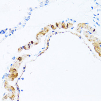 Immunohistochemistry of paraffin-embedded Human liver using NQO2 Polyclonal Antibody at dilution of 1:100 (40x lens).