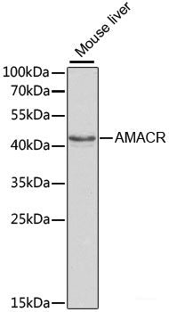 Immunohistochemistry of paraffin-embedded Human breast using TGFBR2 Polyclonal Antibody at dilution of 1:100 (40x lens).