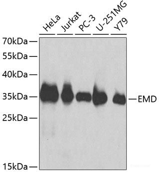 Immunohistochemistry of paraffin-embedded Mouse heart using NOXA2 / P67phox Polyclonal Antibody at dilution of 1:100 (40x lens).