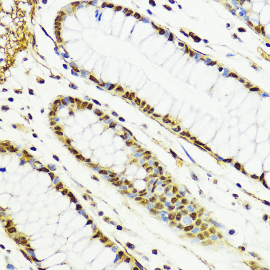 Immunofluorescence analysis of 293T cells using FXN / FRataxin Polyclonal Antibody at dilution of 1:100 (40x lens). Blue: DAPI for nuclear staining.