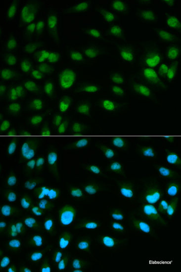 Western blot analysis of extracts of various cell lines using Nestin Polyclonal Antibody at dilution of 1:3000.