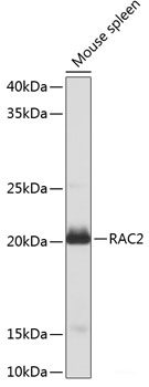 Western blot analysis of extracts of various cell lines using IKB alpha Polyclonal Antibody at dilution of 1:1000.