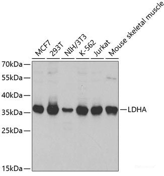 Immunohistochemistry of paraffin-embedded Human colon carcinoma using NOX1 Polyclonal Antibody at dilution of 1:100 (40x lens).