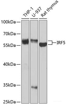 Immunohistochemistry of paraffin-embedded Human breast cancer using ABCC5 Polyclonal Antibody at dilution of 1:100 (40x lens).