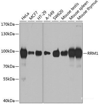 Western blot analysis of extracts of various cell lines using TIMP3 Polyclonal Antibody at dilution of 1:1000.